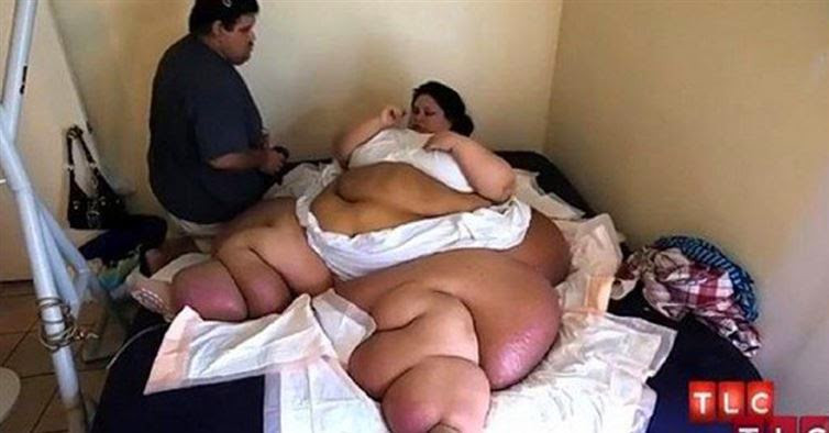 Woman Weighing Over 1000 Pounds Made The Commitment To Lose Weight And You Wont Believe What She Looks Like Now