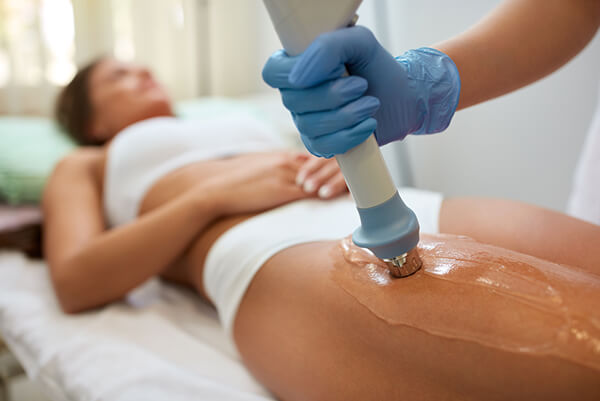 Acoustic Wave Cellulite Therapy