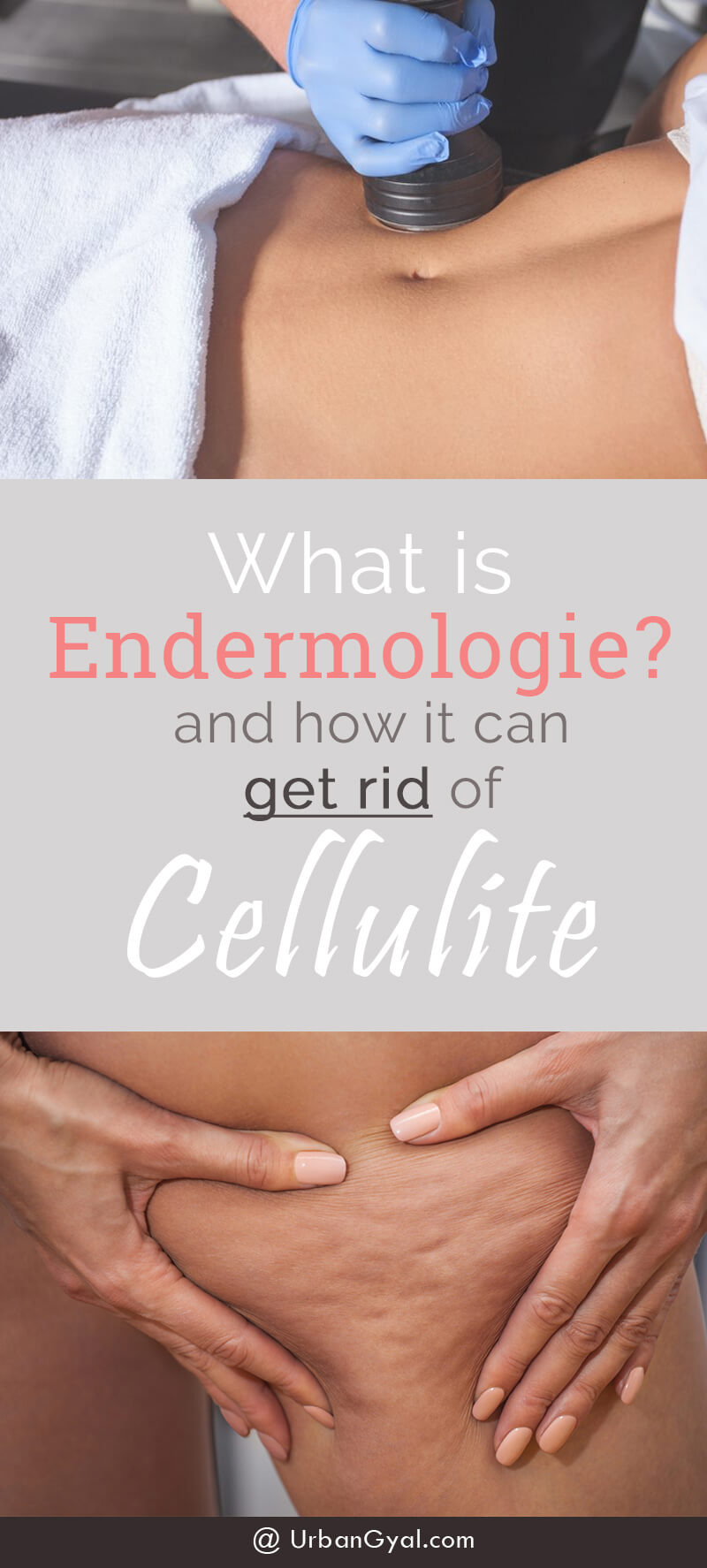 Endermologie Cellulite Treatment