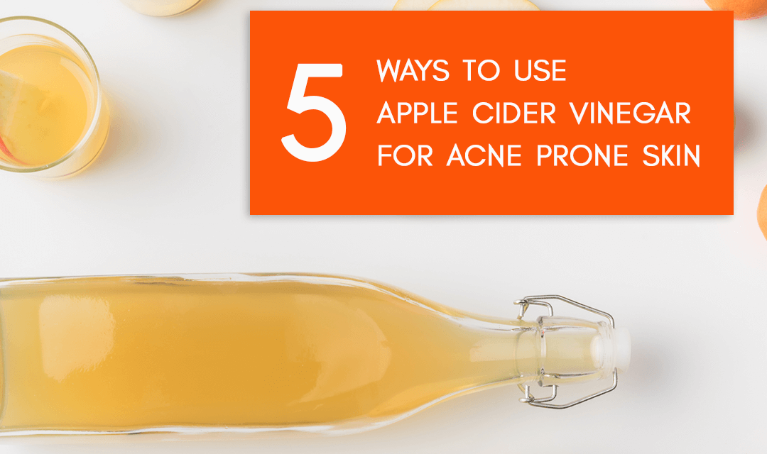 5 Recipes to Use Apple Cider Vinegar for Acne