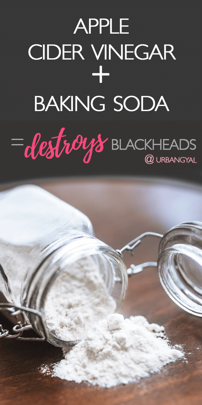 Apple Cider Vinegar plus Baking Soda to Destroy Blackheads