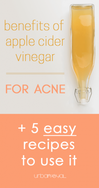 Benefits of Apple Cider Vinegar for Acne