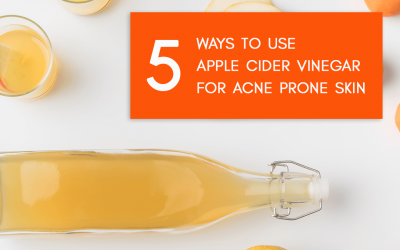 5 Recipes to Use Apple Cider Vinegar for Acne